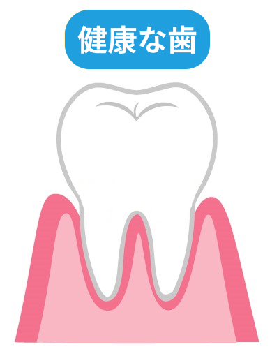 正常な状態
